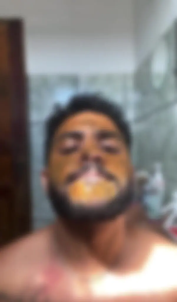 Shit Skincare.